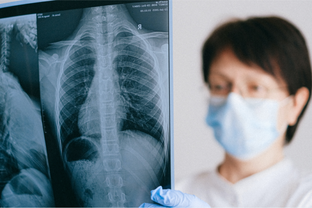 Why is Zero-Emission Urban Transport the Future? — Top 5 Reasons